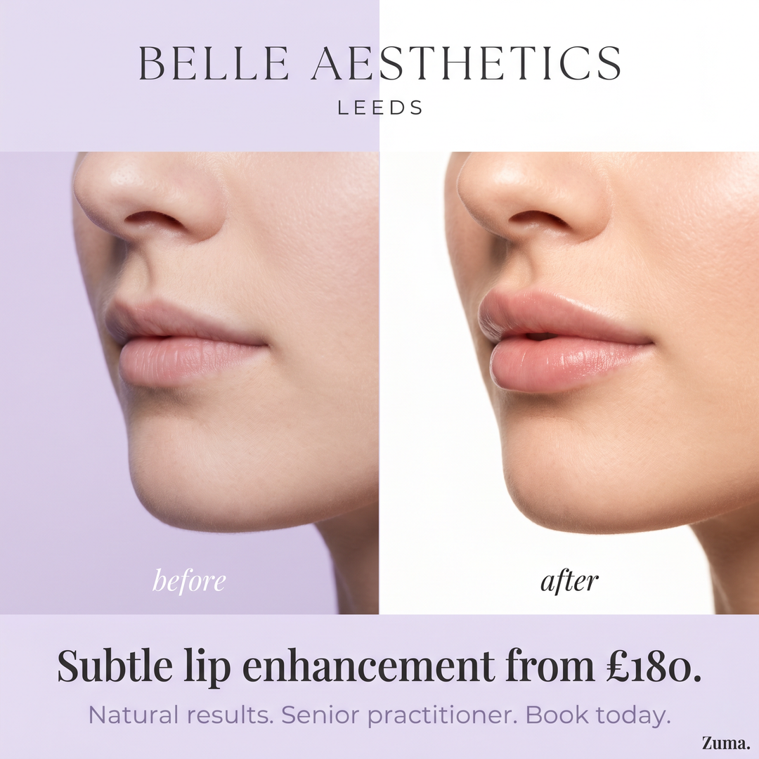 Belle Aesthetics Leeds lip enhancement ad creative
